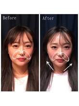 たくろう鍼灸院 豊田本院/Before&After