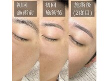 エストアール 博多口店(est-r.)/#美眉#アイブロウスタイリング