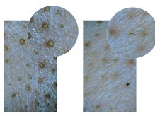 ヘイ 五反田店(hey)/毛穴の汚れとお別れしよう＊