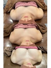 ロココ 豊田店(Rococo)/ビフォーアフター