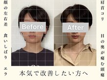 チャンス 西院(chance)の雰囲気（【Google130件以上◎】京都トップレベルの施術！整形級の変化♪）