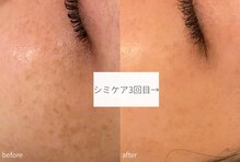 ラシュシュ(La chou chou)