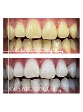 佐賀ホワイトニングラボ/