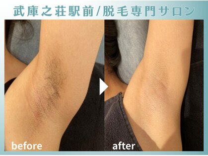 シャーロック(4869Sherlock)の写真