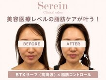 スレーン 上本町(Serein)