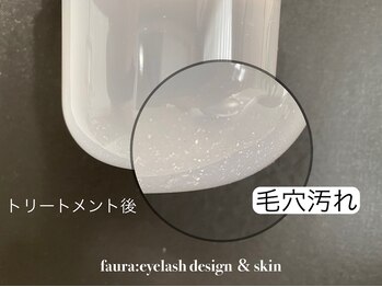ファウラ(faura:)/ハイドロフェイシャル