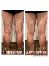 サロン ド リア(salon de Lia)/メンズ全身脱毛