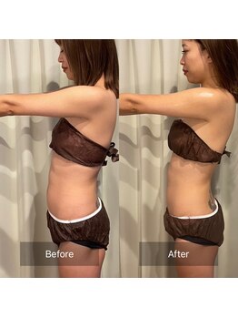 フフラ KANコルギセラピー山梨本店(fufla)/【ウルトランスフォーマー】