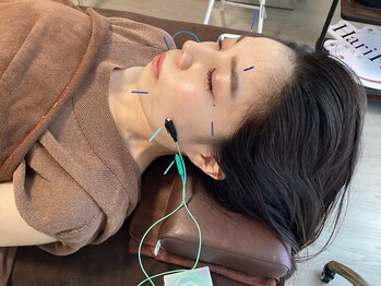 ハリファ鍼灸院 横浜関内院(HariFa鍼灸院)/美容施術