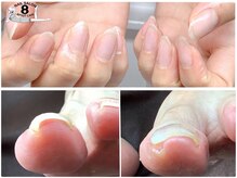 ネイルエイト 新百合ヶ丘(nail8)