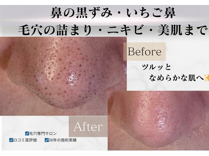 毛穴研究所の写真