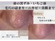 毛穴研究所の写真