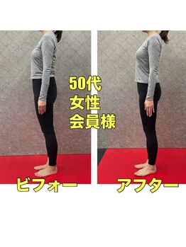BDSの写真/美脚・ヒップラインを整える体型改善