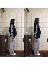 ボディ コンディショニングスペース レゼル(Body Conditioning Space Les Ailes)/横姿勢の変化ビフォーアフター