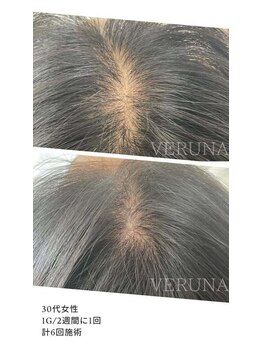 リリーグレース(Lily Grace)/スカルプケア(部分)