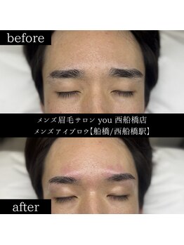 ユー 西船橋店(you)/ビフォーアフター写真