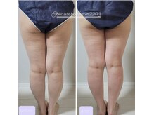 ボーテボナー(Beaute Bonheur)/♪痩身ボディ♪