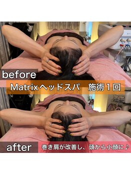 サロンデイジー(Salon Daisy)/Matrix小顔ヘッドスパ★施術一回