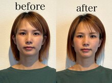 ヴィヴ(Vive)/ドライヘッドスパ60分のお客様