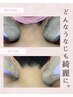 アップもショートも綺麗見せ◎【美肌うなじ脱毛シェービング付】初回¥3,900