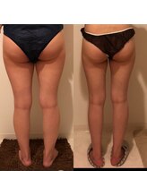 ヨサパーク ラブリエ 吉祥寺店(YOSA PARK La Briller)/回数重ねるほど結果も！