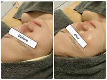 ルル リラクゼーション(RURU Relaxation)/REVIハーブピーリング１回