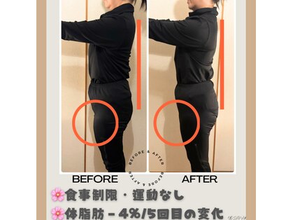 ヨサパーク シアー(YOSA PARK sheer)の写真