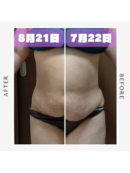 痩身 脱毛専門サロン 椿/小顔キュンキュン