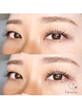 フィグ(fig)/フラットラッシュ(Jカール100本)