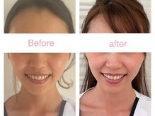 サクラ 伊勢原店(SAKURA)/当フェイシャルエステは差別化◎