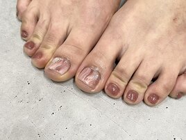 フット親指2本アート