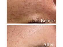 MMK/印象が変わるマイナス5歳肌