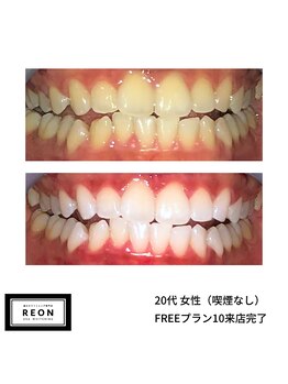 レオン 磐田(REON)/◇ お客様 before＆after ◇