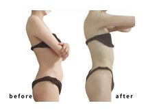 リカバリー(&recovery)/肩甲骨剥がし＆背肉のrecovery