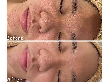 アイティス(Salon Its)/【Before &After】