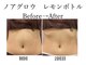スターティス(STATICE)の写真