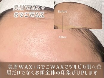 レイ 宮崎駅東店(Rey)/オプション/おでこ・こめかみWAX