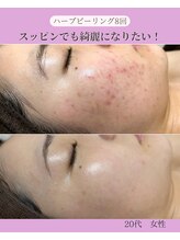 ホリホック/すっぴんでも綺麗になりたい！