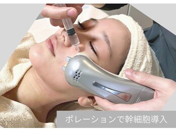 リグレア 浦安(Re.GLARE)/幹細胞導入