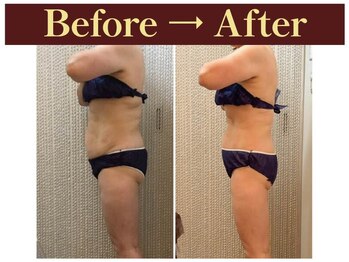 クオレ(CUORE)/ビフォーアフター