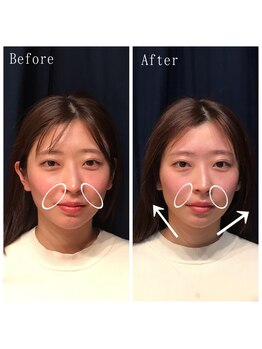 たくろう鍼灸院 豊田本院/Before&After