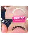 巻き爪ケアジェル[宇都宮/雀宮]