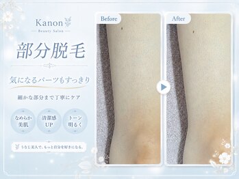 カノン 南熊本店(Kanon)/