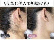 アルゴ 福津店(ALGO)の雰囲気（自己処理では難しい”うなじ”もこんなに綺麗に♪）