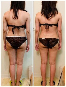 モカ(MOKA)/ボディが変わると10歳若見え!