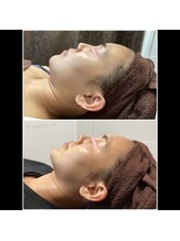 プリマプリート 岐阜店/VOSグレーズソフトピール