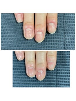 ウェルズユキ(well's yuki)/手を見られるのがコンプレックス