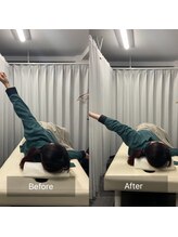 ナオル整体 池尻大橋院(NAORU整体)/肩の開き改善<30代女性>