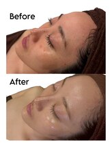 ビューティースタイリング 自由が丘店(beauty styling)/【アンストレス】