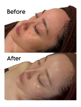 ビューティースタイリング 自由が丘店(beauty styling)/【アンストレス】